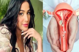 Model and Actress Poonam Pandey has died of cervical cancer at the age of 32, her team has announced